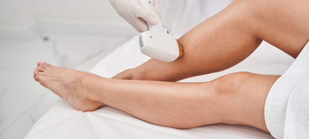 the benefits of laser hair removal