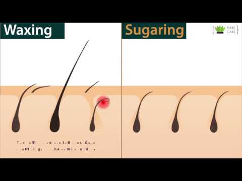 post waxing ingrown hairs aftercare guide